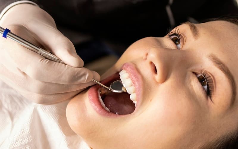 What is Full Mouth Rehabilitation? A Guide for Chennai Patients