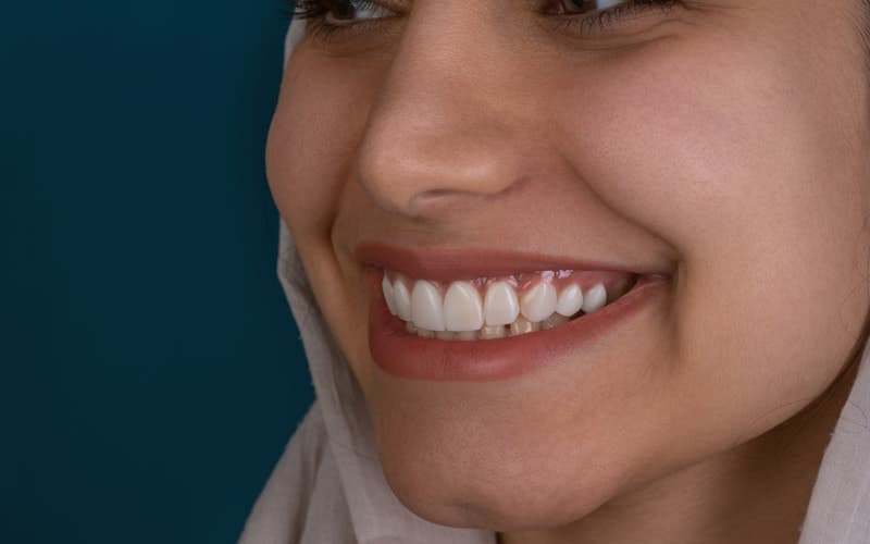Smile Makeover Checklist, Am I a Good Candidate?
